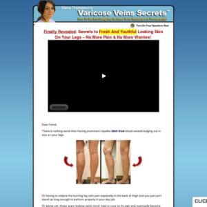 Get Rid Varicose Veins Naturally ** Hot Niche - 70%/sale