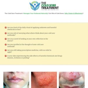 Cold Sore Treatment - How to Get Rid of Cold Sores Faster
