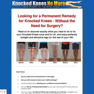 Knocked Knees No More - How to Straighten Your Legs Without Surgery!