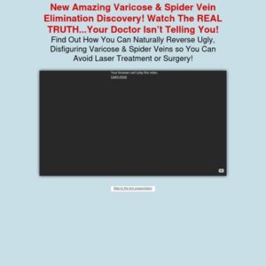 Varicose Veins Natural Treatment | Varicose Veins Home Treatment Program